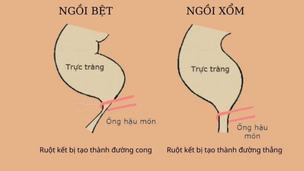 ban co biet tu the di ve sinh nao dung nhat va tot cho suc khoe