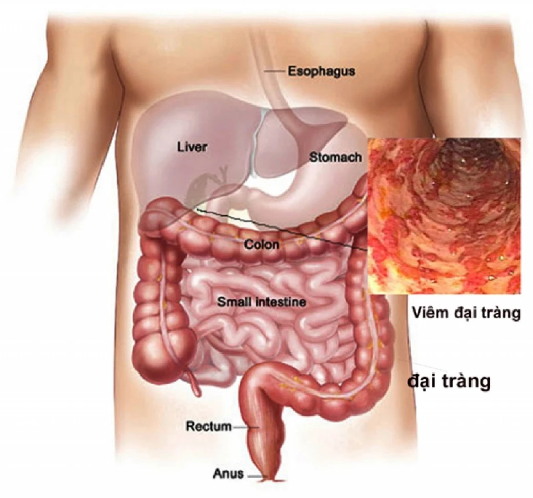 di ve sinh sai cach tac dong khong tot den suc khoe